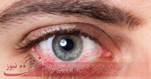 6 عفونت‌ چشمی که می‌توانند عواقب فاجعه‌باری داشته باشند