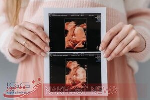 اولین سونوگرافی بارداری چه زمانی باید انجام شود؟