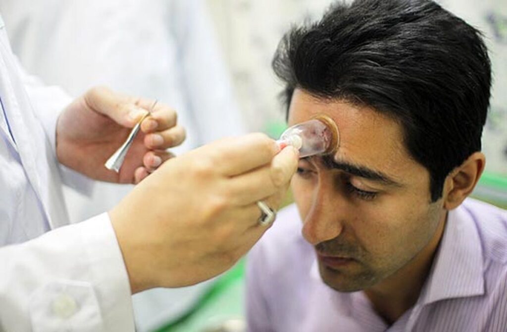 بهترین فصل حجامت بهار است؟