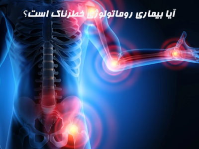 آیا بیماری روماتولوژی خطرناک است؟