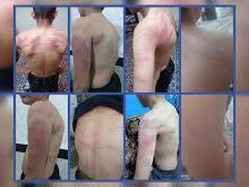شکنجه‌ ۱۳ دانش‌آموز توسط معلم به ‌دلیل گم‌شدن شارژر