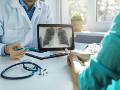 سرطان ریه؛ شایع و با مرگ‌ومیر بالا