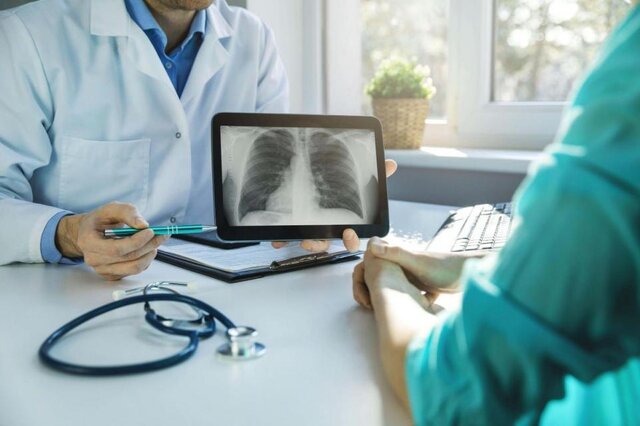 سرطان ریه؛ شایع و با مرگ‌ومیر بالا