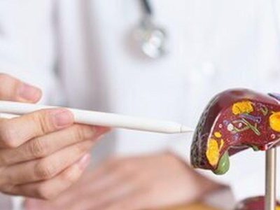 کبد چرب را به این روش خیلی راحت تشخیص دهید