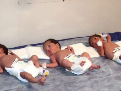 ثبت بیش از ۱۱ هزار واقعه ولادت چند قلوزایی طی امسال