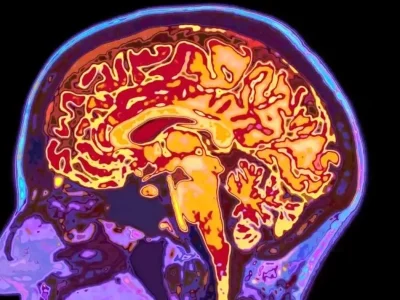 چرا مغز تا ۳۲ سالگی مثل یک نوجوان رفتار می‌کند؟