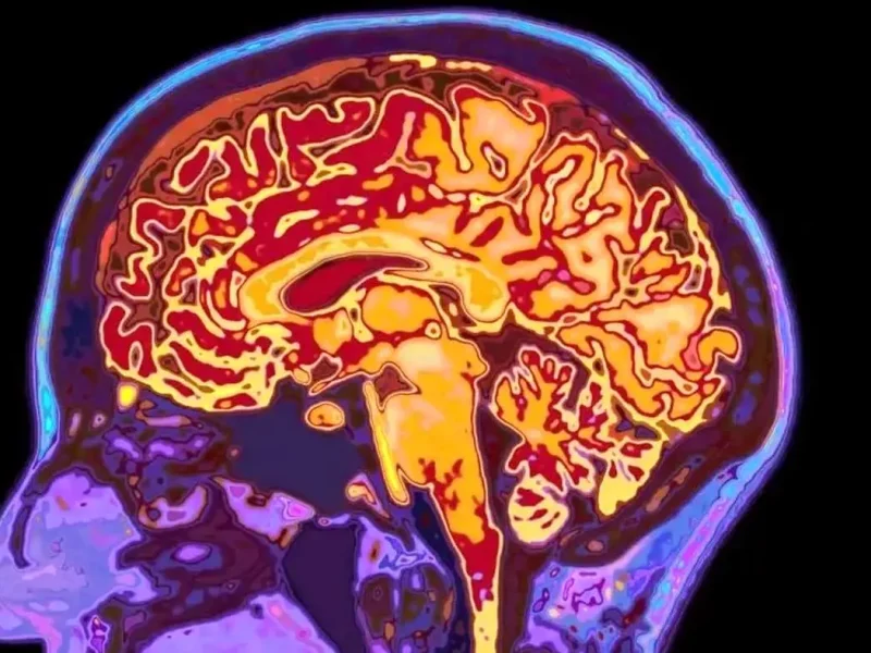 چرا مغز تا ۳۲ سالگی مثل یک نوجوان رفتار میکند؟