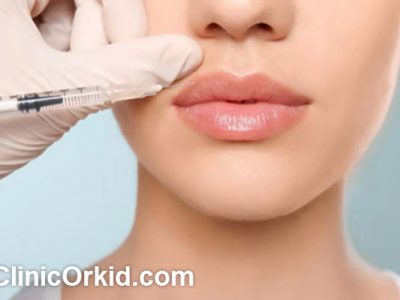 بهترین دکتر برای تزریق ژل در غرب تهران